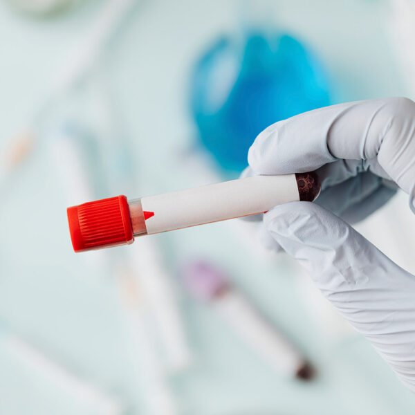 Prueba rapida E coli Test